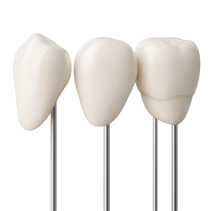 Muestras de carillas de porcelana